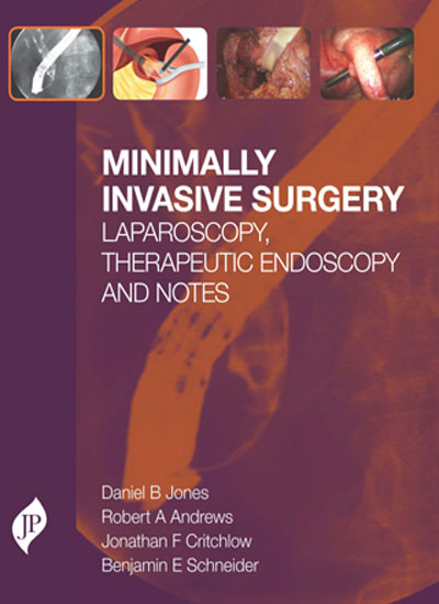MINIMALLY INVASIVE SURGERY LAPAROSCOPY,THERAPEUTIC ENDOSCOPY AND NOTES 1/E, 2015, DANIEL B JONES
