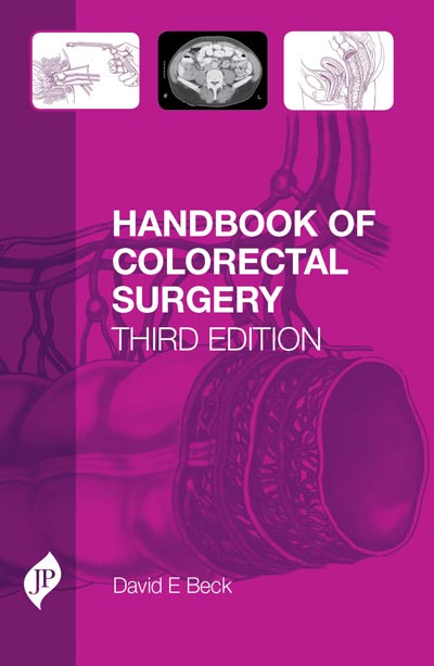 HANDBOOK OF COLORECTAL SURGERY 3/E, 2013, DAVID E BECK
