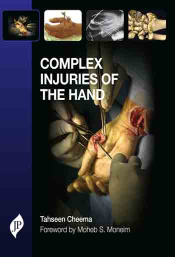 COMPLEX INJURIES OF THE HAND 1/E, 2014, TAHSEEN A CHEEMA