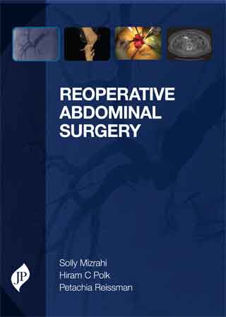 REOPERATIVE ABDOMINAL SURGERY 1/E, 2014, SOLLY MIZRAHI