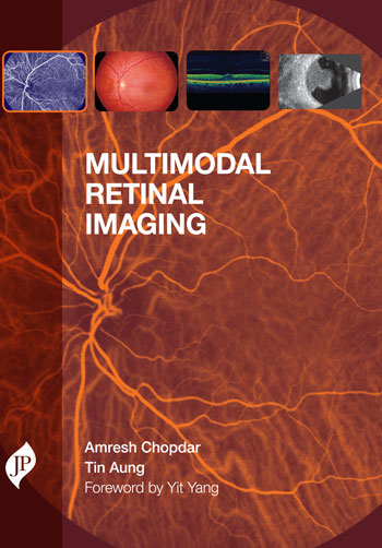 MULTIMODAL RETINAL IMAGING 1/E, 2014, AMRESH CHOPDAR