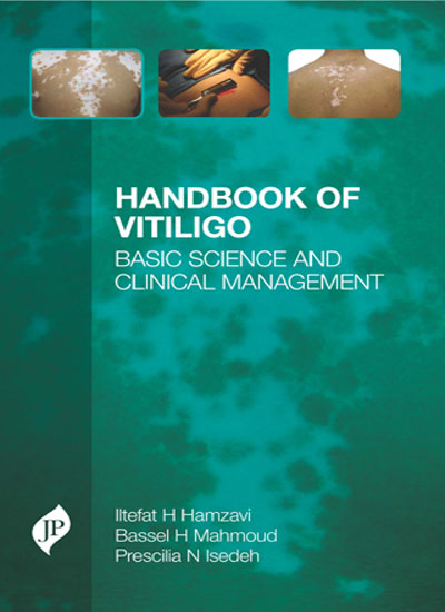 HANDBOOK OF VITILIGO BASIC SCIENCE AND CLINICAL MANAGEMENT 1/E, 2016, ILTEFAT H HAMZAVI