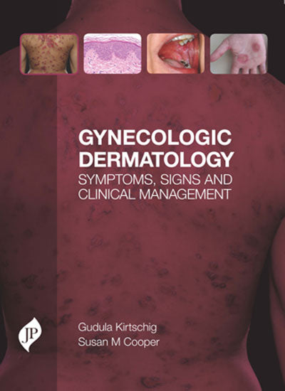 GYNECOLOGIC DERMATOLOGY SYMPTOMS, SIGNS AND CLINICAL MANAGEMENT 1/E, 2016, GUDULA KIRTSCHING