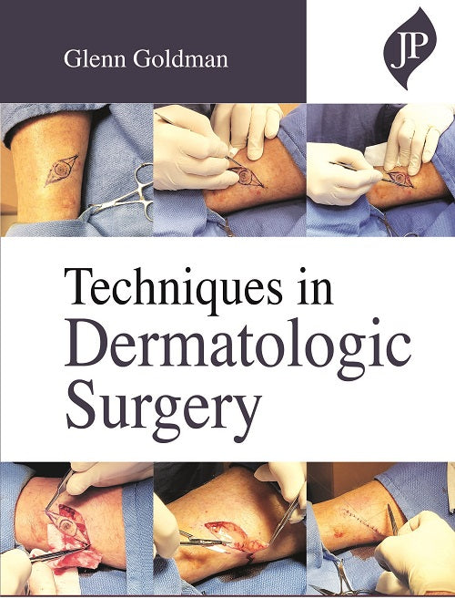 TECHNIQUES IN DERMATOLOGIC SURGERY 1/E, 2021, GLENN GOLDMAN