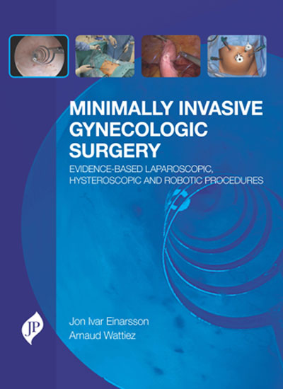MINIMALLY INVASIVE GYNECOLOGIC SURGERY EVIDENCE-BASED LAP.HYSTER. AND ROBOTIC PROCEDURES 1/E, 2016, JON IVAR EINARSSON