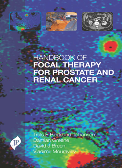 HANDBOOK OF FOCAL THERAPY FOR PROSTATE AND RENAL CANCER 1/E, 2017, TRULS E BJERKLUND JOHANSEN