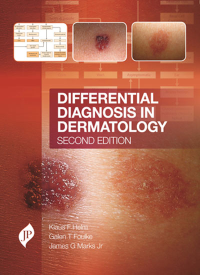 DIFFERENTIAL DIAGNOSIS IN DERMATOLOGY 2/E, 2018, KLAUS F.HELM
