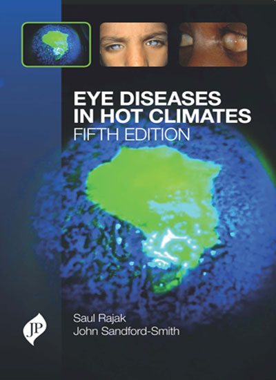 EYE DISEASES IN HOT CLIMATES 5/E, 2015, SAUL RAJAK