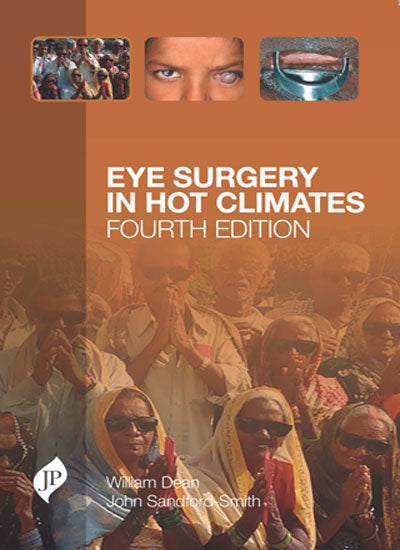EYE SURGERY IN HOT CLIMATES 4/E, 2015, WILLIAM DEAN
