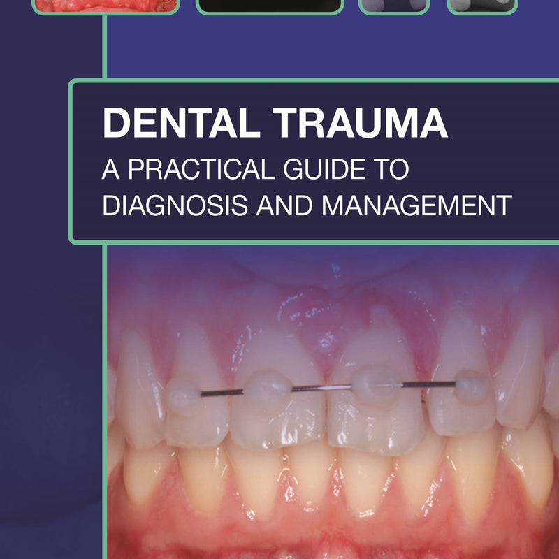 DENTAL TRAUMA: A PRACTICAL GUIDE TO DIAGNOSIS AND MANAGEMENT 1/E, 2021, SERPIL DJEMAL
