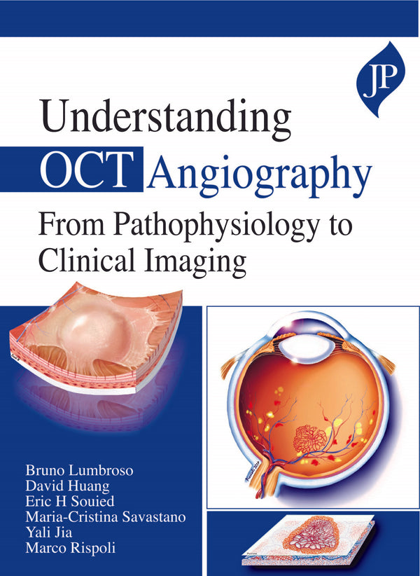 UNDERSTANDING OCT ANGIOGRAPHY FROM PATHOPHYSIOLOGY TO CLINICAL IMAGING 1/E, 2020, BRUNO LUMBROSO
