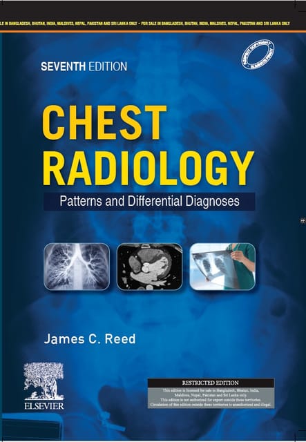 Chest Radiology: Patterns and Differential Diagnoses, 7e, Reed, James