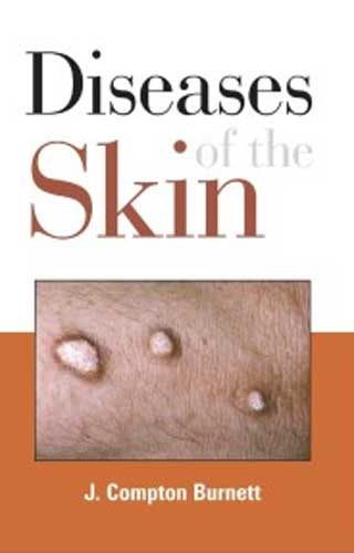 DISEASES OF THE SKIN 1ST/e, by BURNETT JC