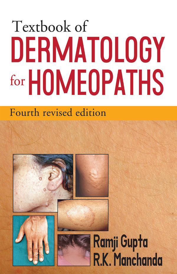 T.B OF DERMATOLOGY FOR HOM 4TH/e, by GUPTA / MANCHANDA