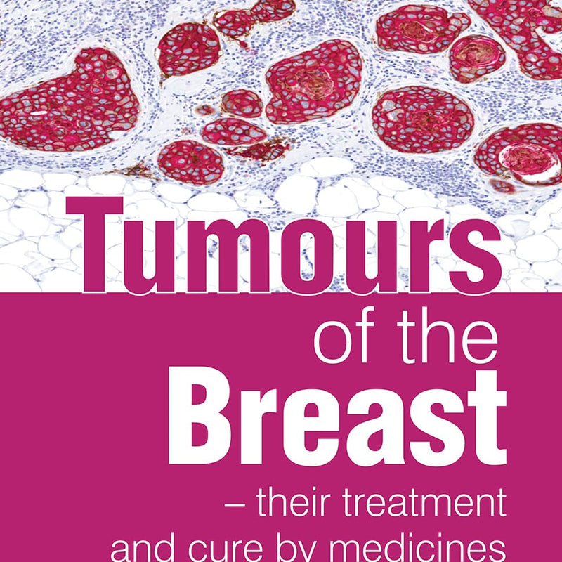 TUMOURS OF THE BREAST  1ST/e, by BURNETT JC