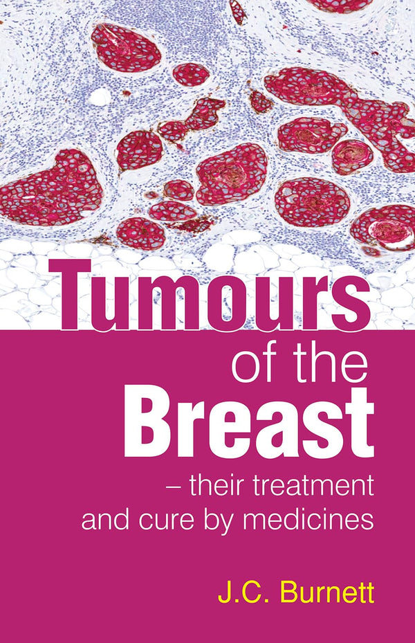 TUMOURS OF THE BREAST  1ST/e, by BURNETT JC