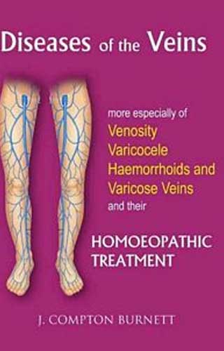 DISEASES OF THE VEINS 1ST/e, by BURNETT JC