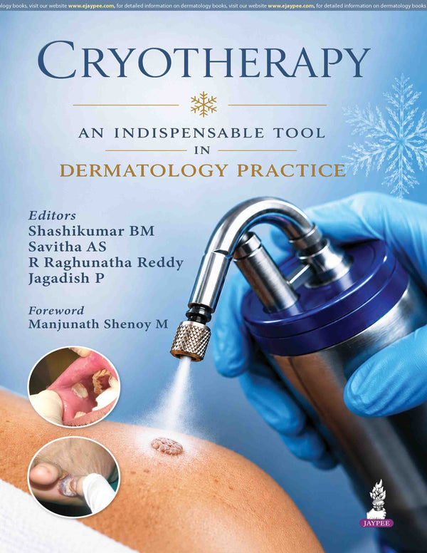 CRYOTHERAPY AN INDISPENSABLE TOOL IN DERMATOLOGY PRACTICE, 1/E, BY, SHASHIKUMAR BM