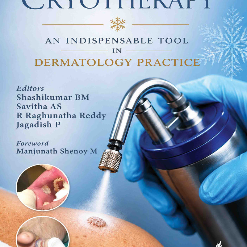 CRYOTHERAPY AN INDISPENSABLE TOOL IN DERMATOLOGY PRACTICE, 1/E, BY, SHASHIKUMAR BM