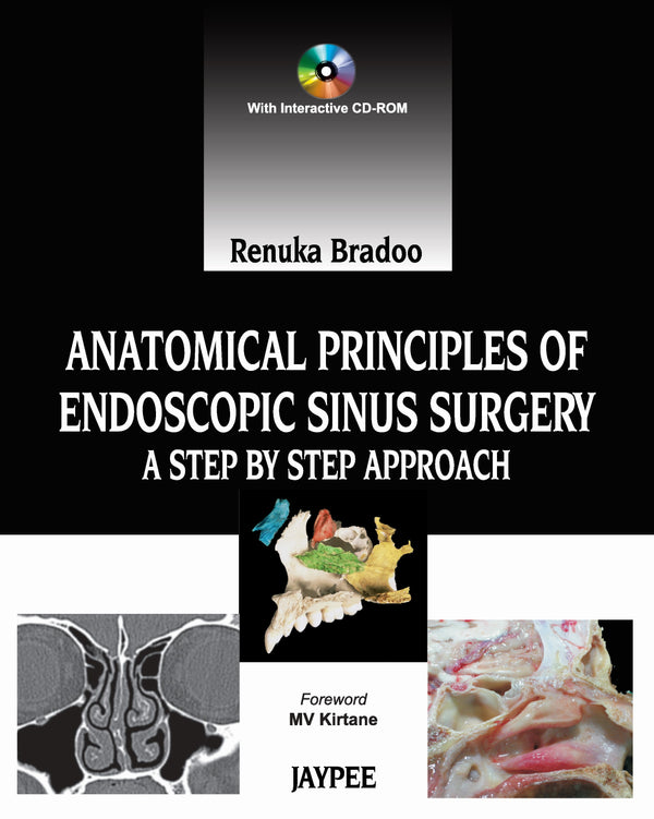 ANATOMICAL PRINCIPLES OF ENDOSCOPIC SINUS SURGERY: A STEP BY STEP APPROACH WITH INTERACTIVE CD-ROM 1/E R.P., 2012, RENUKA BRADOO