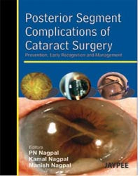 POSTERIOR SEGMENT COMPLICATIONS OF CATARACT SURGERY PREV.,EARLY RECOG.AND MANAGEMENT, 1/E, BY, NAGPAL