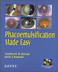 PHACOEMULSIFICATION MADE EASY WITH 2 INT.CD ROMS 1/E, 2006, AASHEET H DESAI