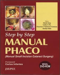 STEP BY STEP MANUAL PHACO WITH DVD-ROM, 1/E, BY, ASHOK GARG