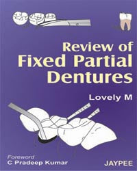 REVIEW OF FIXED PARTIAL DENTURES 1/E, 2006, LOVELY M