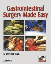 GASTROINTESTINAL SURGERY MADE EASY WITH 2 INTRACTIVE CD-ROMS 1/E, 2007, S DEVAJI RAO