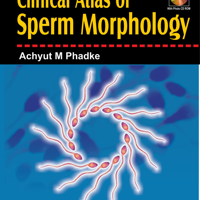 CLINICAL ATLAS OF SPERM MORPHOLOGY WITH PHOTO CD ROM, 1/E, BY, ACHYUT M PHADKE