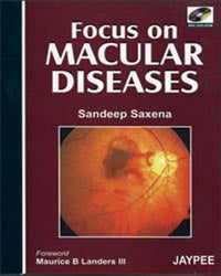 FOCUS ON MACULAR DISEASES WITH DVD-ROM 1/E, 2007, SANDEEP SAXENA
