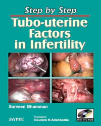 STEP BY STEP TUBO-UTERINE FACTORS IN INFERTILITY (WITH DVD-ROM), 1/E, BY, SURVEEN GHUMMAN