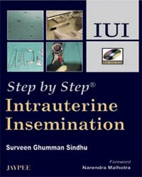 STEP BY STEP INTRAUTERINE INSEMINATION IUI WITH DVD-ROM, 1/E, BY, SURVEEN GHUMMAN SINDHU