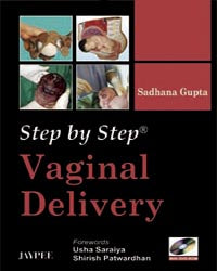 STEP BY STEP VAGINAL DELIVERY WITH DVD-ROM, 1/E, BY, SADHANA GUPTA