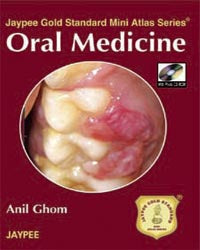 ORAL MEDICINE WITH PHOTO CD-ROM JAYPEE GOLD STANDARD MINI ATLAS SERIES 1/E, 2008, ANIL GHOM