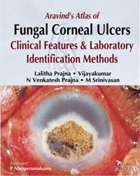 ARAVIND'S ATLAS OF FUNGAL CORNEAL ULCERS CLINICAL FEATURES & LAB.IDENTIFICATION METHODS, 1/E, BY, LALITHA PRAJNA