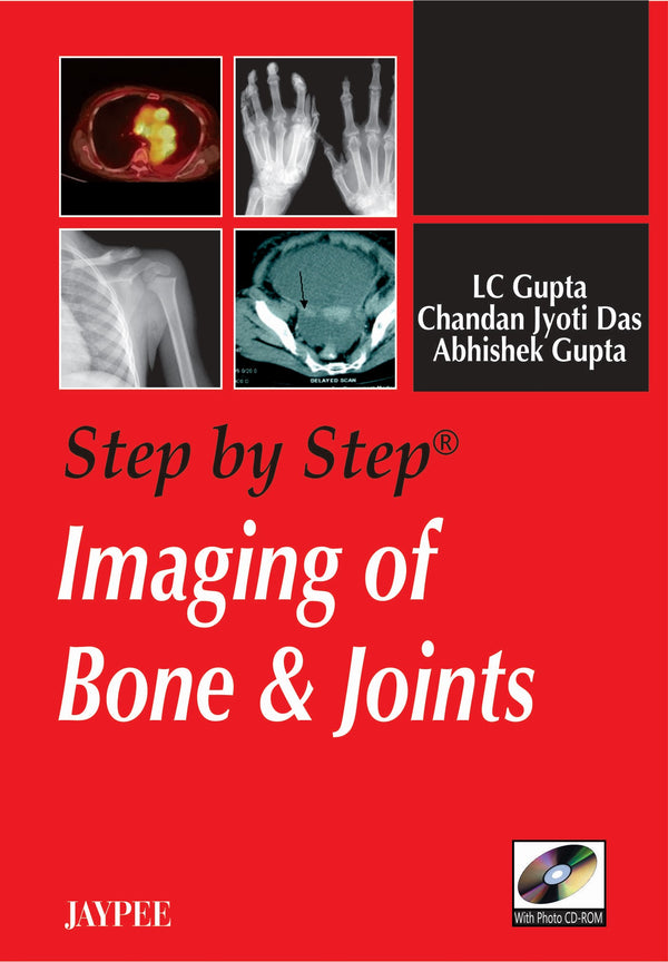 STEP BY STEP IMAGING OF BONE & JOINTS WITH PHOTO CD-ROM 1/E, 2008, LC GUPTA