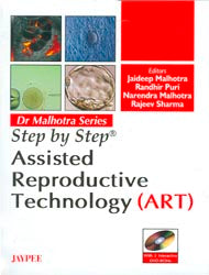 STEP BY STEP ASSISTED REPRODUCTIVE TECHNOLOGY(ART) WITH 2 INT.DVD-ROMS DR.MALHOTRA SERIES, 1/E, BY, JAIDEEP MALHOTRA