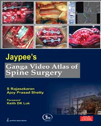 JAYPEE'S GANGA VIDEO ATLAS OF SPINE SURGERY OVER 50 PROC.IN 6 DVDS, 1/E, BY, S RAJASEKARAN