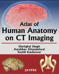 ATLAS OF HUMAN ANATOMY ON CT IMAGING, 1/E, BY, HARIQBAL SINGH