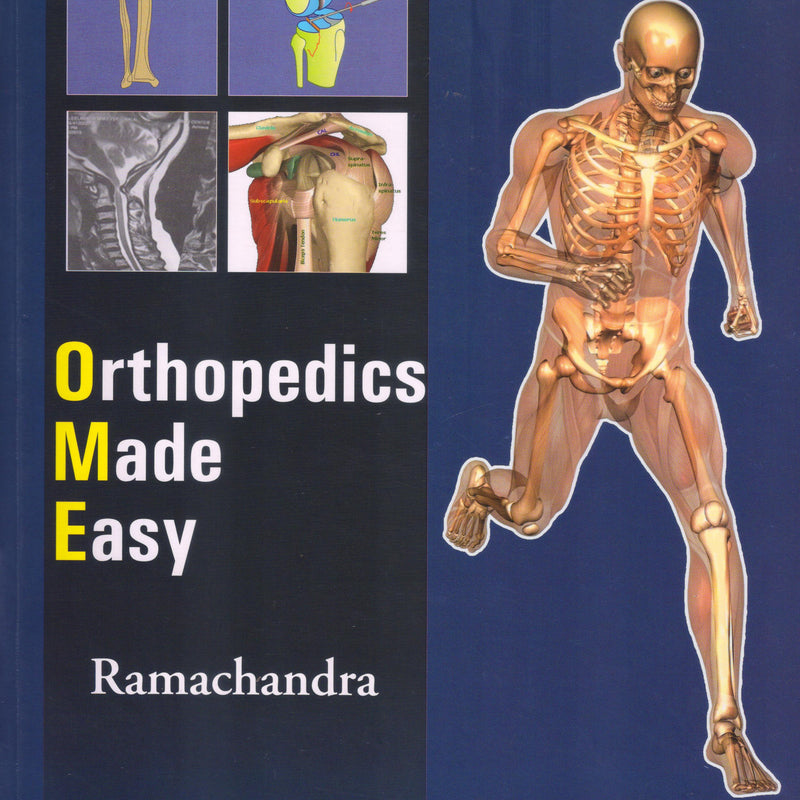 Orthopedics Made Easy 1st/e by  Ramachandra