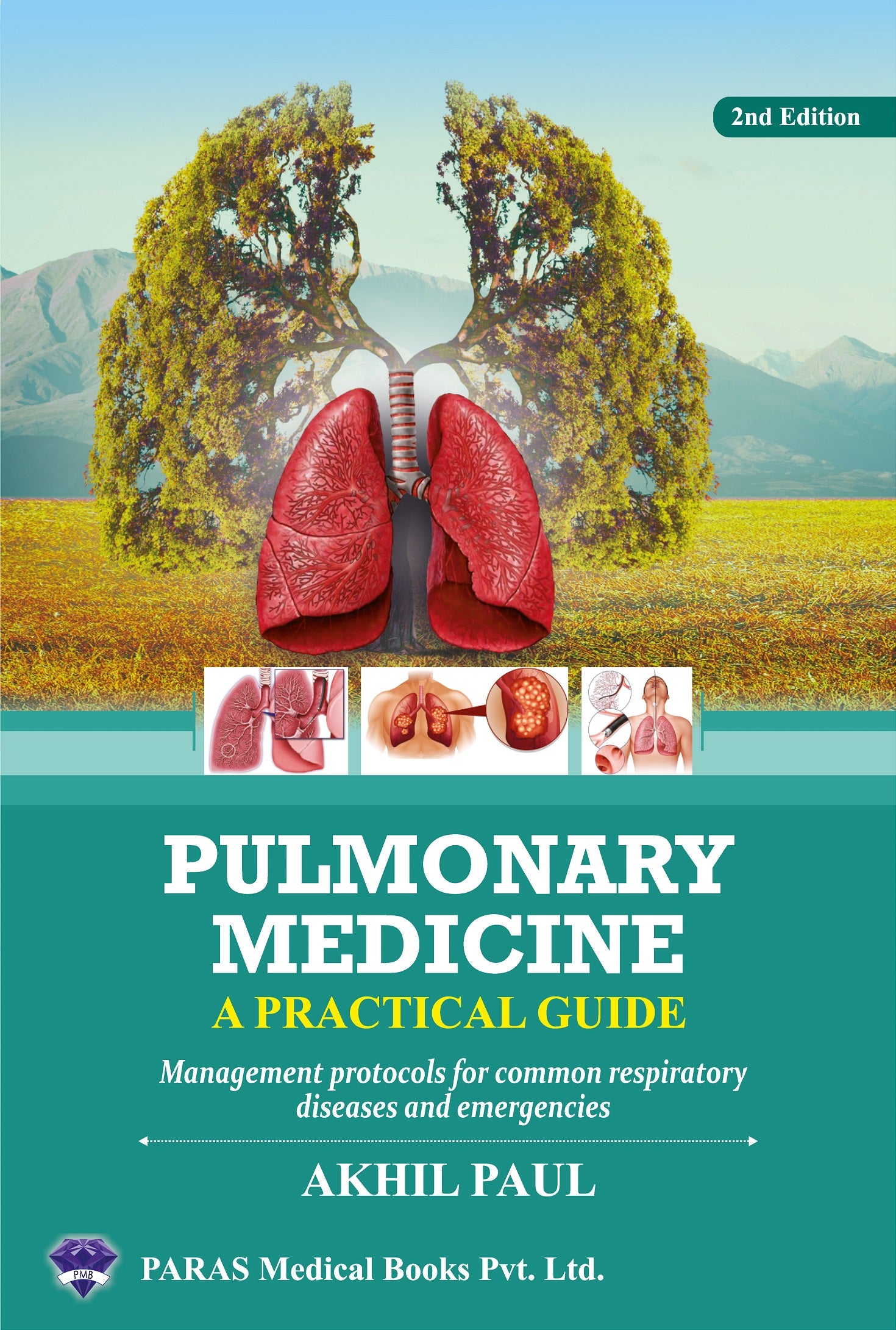 Pulmonary Medicine A Practical Guide 2nd/2024 by Akhil Paul