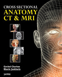 CROSS SECTIONAL ANATOMY CT AND MRI 1/E, 2012, GOVIND B CHAVHAN