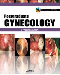 POSTGRADUATE GYNAECOLOGY WITH DVD ROM, 1/E, BY, PRESANNAKUMARI