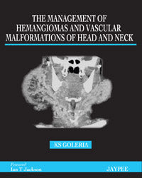 THE MANAGEMENT OF HEMANGIOMAS AND VASCULAR MALFORMATIONS OF HEAD AND NECK, 1/E, BY, DHIMANT GOLERIA
