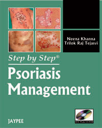 STEP BY STEP PSORIASIS MANAGEMENT WITH PHOTO CD-ROM, 1/E, BY, NEENA KHANNA