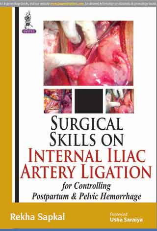 SURGICAL SKILLS ON INTERNAL ILIAC ARTERY LIGATION:FOR CONTROLLING POSTPARTUM & PELVIC HEMORRHAGE, 1/E, BY, REKHA SAPKAL