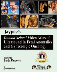 DONALD SCHOOL VIDEO ATLAS OF ULTRASOUND IN FETAL ANOMALIES AND GYNE.ONCOLOGY BOOK WITH SLIPCASE 1/E, 2012, SANJA KUPESIC