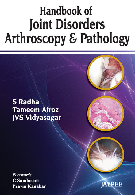 HANDBOOK OF JOINT DISORDERS ARTHROSCOPY & PATHOLOGY 1/E, 2013, S RADHA