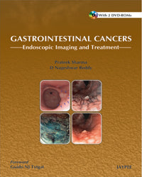 GASTROINTESTINAL CANCERS ENDOSCOPIC IMAGING AND TREATMENT WITH 2 DVD-ROMS, 1/E, BY, PRATEEK SHARMA